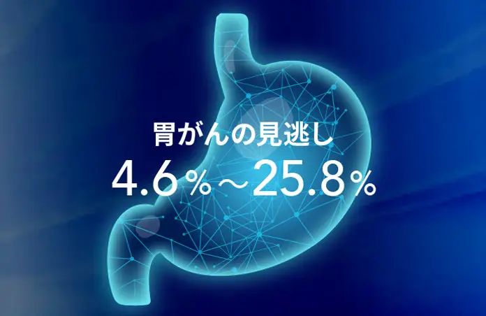 胃がんの見逃し4.6%~25.8%