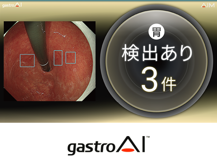 gastroAI model-G2