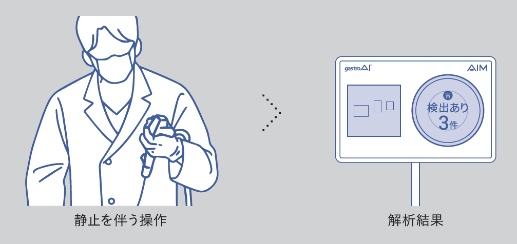 内視鏡検査中のご利用の流れについてのイラスト